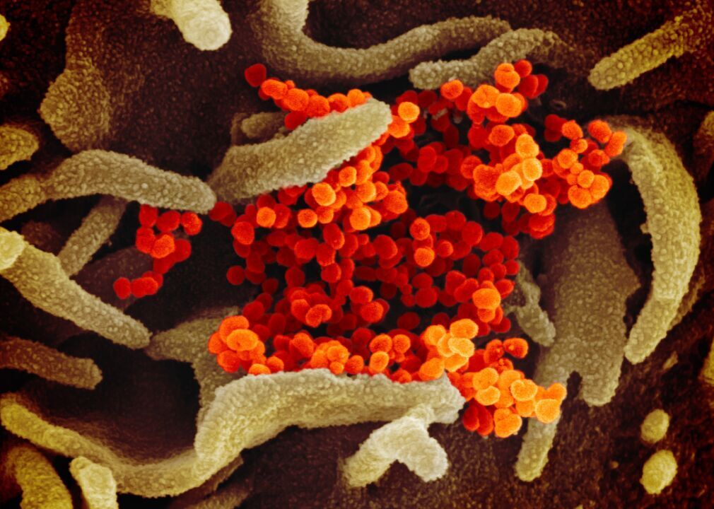 Evolutionary origin of SARS-CoV-2